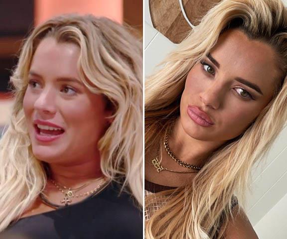 **Tilly Whitfield, season 13** <br><br>
She'd already had a few cosmetic tweaks when she starred on BB and has added to them since, the star confessing to having lip filler, Botox and more. She explained on Instagram that she wants to be open about her makeover for a reasion, writing: "I really want to normalise people with a platform informing their audience about what cosmetic surgeries and procedures they've had done."