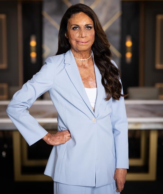 **Turia Pitt**
<br><br>
[Turia](https://www.nowtolove.com.au/news/real-life/turia-pitt-and-michael-hoskin-love-story-in-pictures-31372|target="_blank") was fired in the 12th episode after her team failed the social media challenge. The teams were tasked with writing, shooting and editing a short video in line with TikTok stars the Inspired Unemployed's style. 
<br><br>
However, Turia took over and produced an unfunny video that didn't resonate with viewers. Amy, Benji and Turia landed themselves in the boardroom, but the motivation speaker was ultimately fired by Lord Sugar.