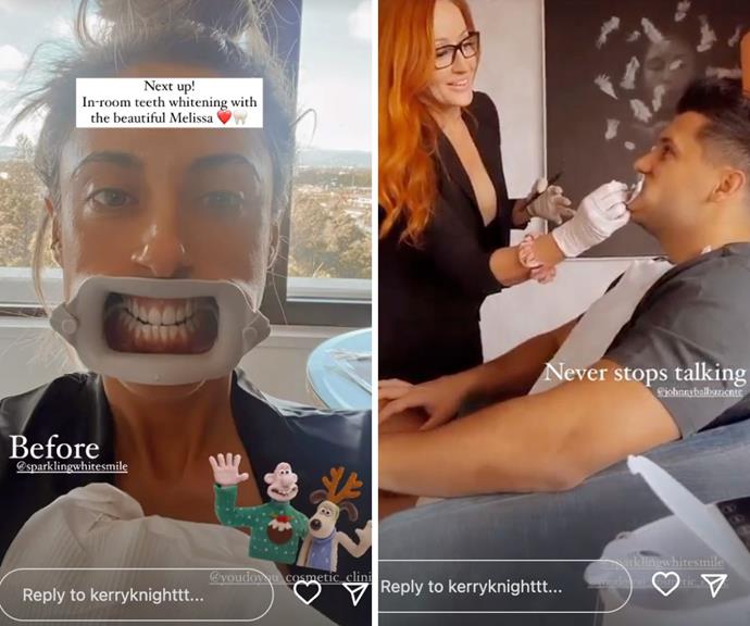 Rather than show off their makeup, tanning or outfit process, *Married At First Sight* super couple Kerry Knight and Johnny Balbuziente showed a rare glimpse at their teeth being whitened ahead of the awards ceremony.