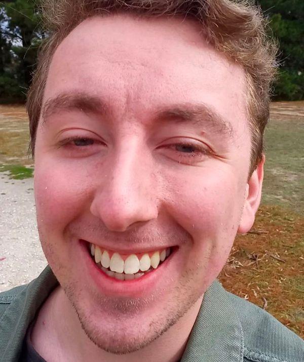 **Kyle Blaize**
<br><br>
The braces are finally gone! After seven years, Kyle's pearly whites are finally looking perfect and have boosted this history buff and artist's confidence since his time on *BATG*.
<br><br>
He's also been working as a CFS volunteer fire-fighter, so props to him.