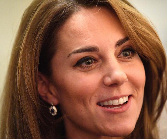 Plastic surgery clinic slammed for misusing Kate Middleton's face to promote face lift