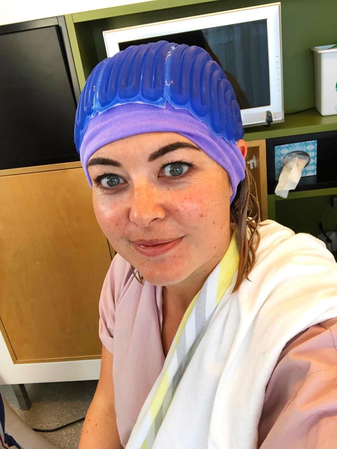 Sarah was able to save 90% of her hair by using a "cold cap" during chemo.