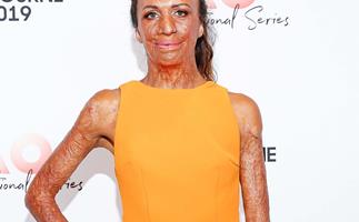 'It's exhausting': Turia Pitt shares emotional message about the reality of caring for a newborn