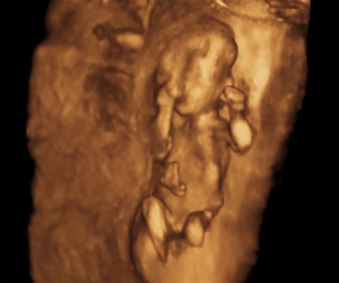 A 4D scan of the growing baby.