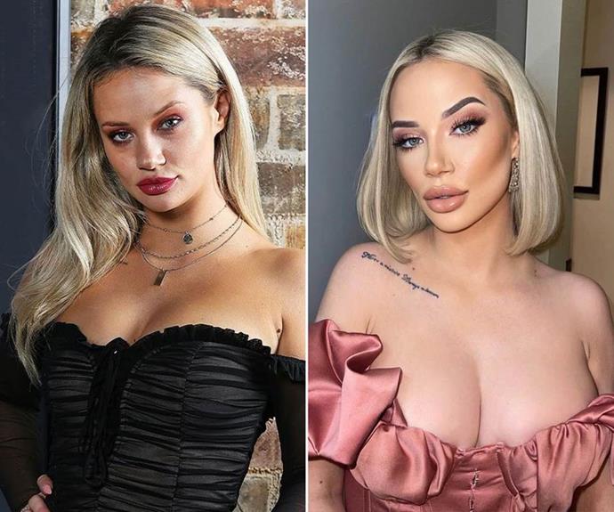 **Jessika Power, season six**


Jess has undergone one of the most dramatic transformations, undergoing procedures including cheek Botox, jaw slimming and a fat transfer to her breasts. The star admitted she spent more than $60,000 on procedures over 18 months at one point.

(Image: Nine/Instagram)
