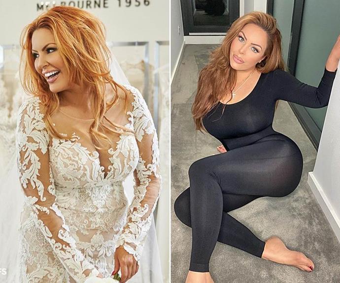 **Sarah Roza, season five**


This bride showed off her tiny waist and slimmer figure after undergoing a cosmetic procedure to drop a few kilos in 2021. "It is Vaser Liposuction and I have had pretty much my whole body (done) from my neck down," the she told The Herald Sun.

(Image: Nine/Instagram)