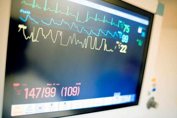 Acting fast after a cardiac arrest can save lives