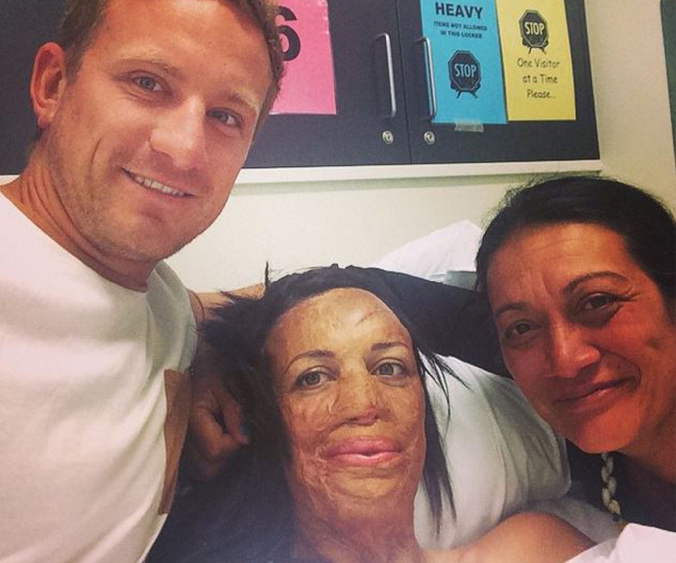 In pictures: Turia Pitt and Michael Hoskin's love story:But in 2011 Turia suffered burns to 65 per cent of her body, lost her fingers and thumb on her right hand and spent five months in hospital after she was trapped by a grassfire in a 100 kilometre ultra-marathon in the Kimberley.