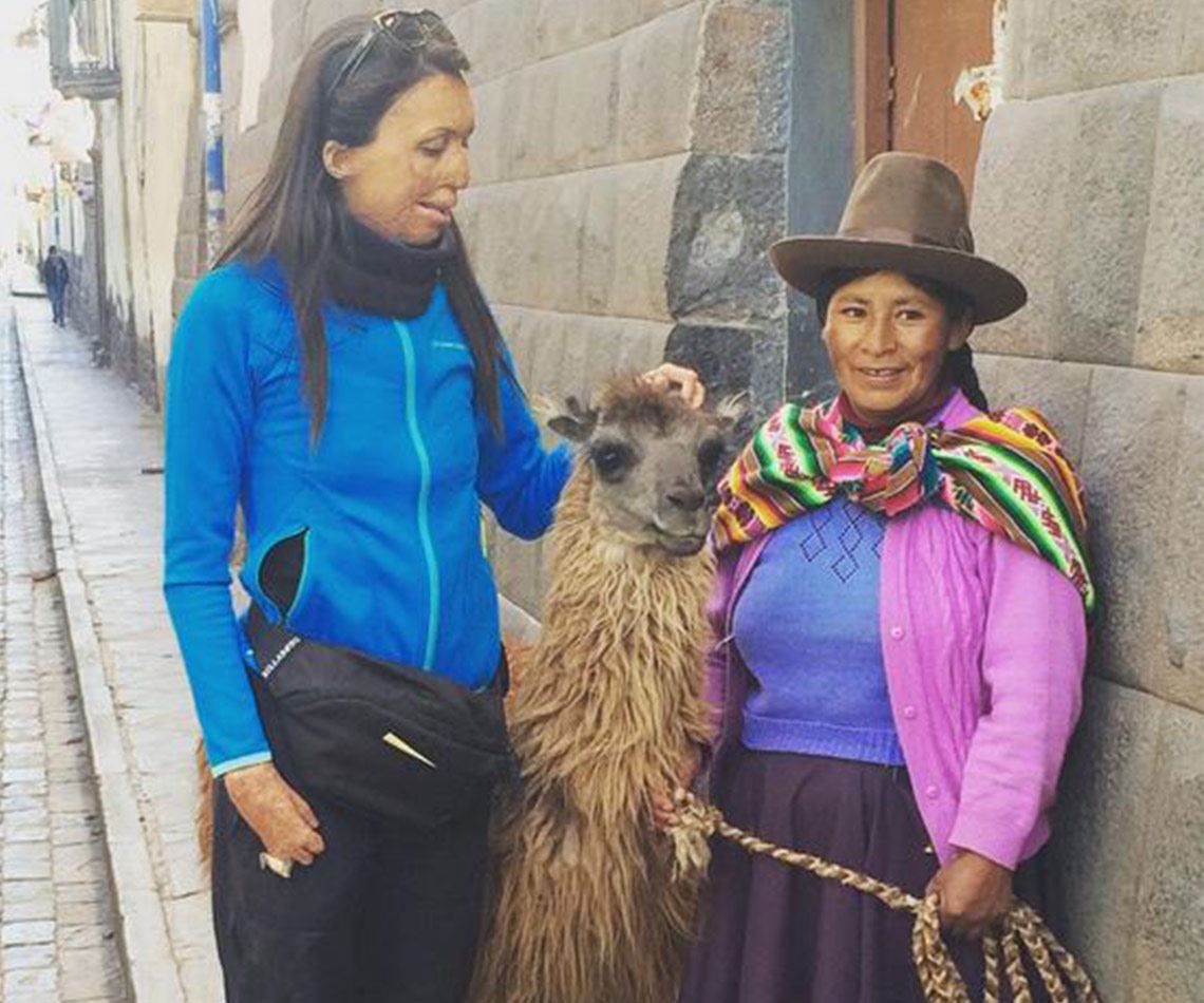 In pictures: Turia Pitt and Michael Hoskin's love story:Turia hasn't let anything stop her quest for adventure and discovery and [welcomed her 28th birthday](http://www.womansday.com.au/celebrity/australian-celebrities/turia-pitt-turns-28-13205) by climbing Machu Picchu.