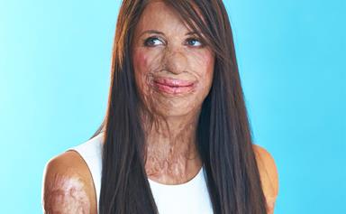 In pictures: Turia Pitt's most inspirational moments