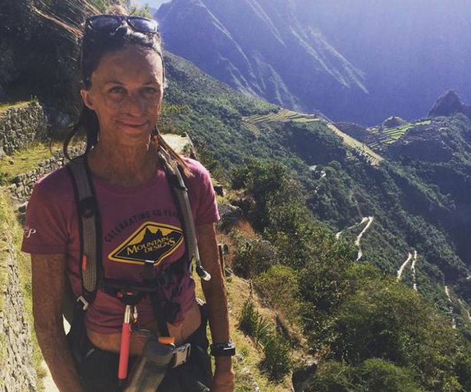 In a selfless bid to raise money for Interplast – a not-for-profit organisation which provides free reconstructive surgery for people who have suffered from cleft palates or burns around the world - Turia took on the Inca Trail.