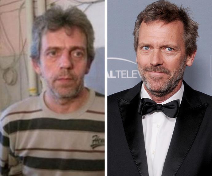 We bet this guy gets a lot of people coming up to him and asking him about their bumps and lumps! He looks just like Hugh Laurie, AKA Dr House!