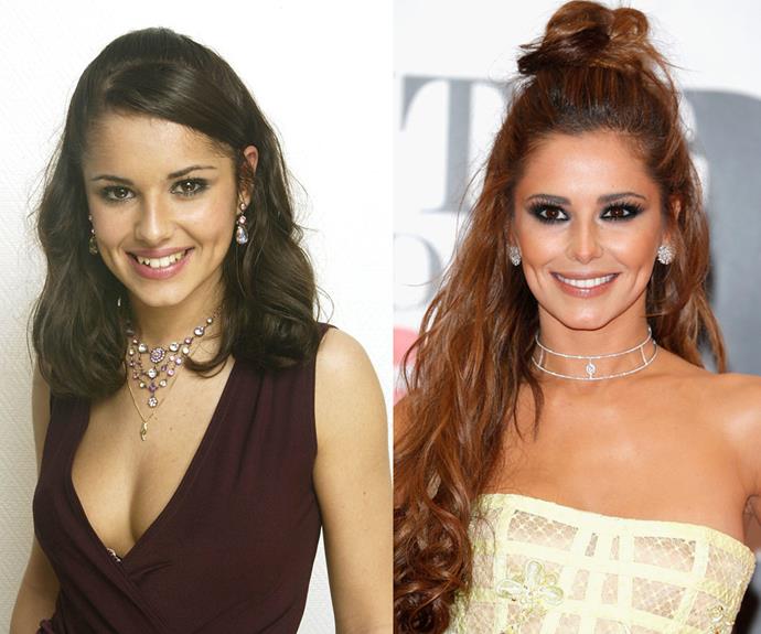 Cheryl Fernandez-Versini's smile has rapidly changed since 2001 (L) and her nose also appears to have narrowed. "[She's had] veneers but unfortunately she's also had an overdone nose job with a pointy tip, narrow dorsal aesthetic line and poorly supported nostrils," our surgeon says.