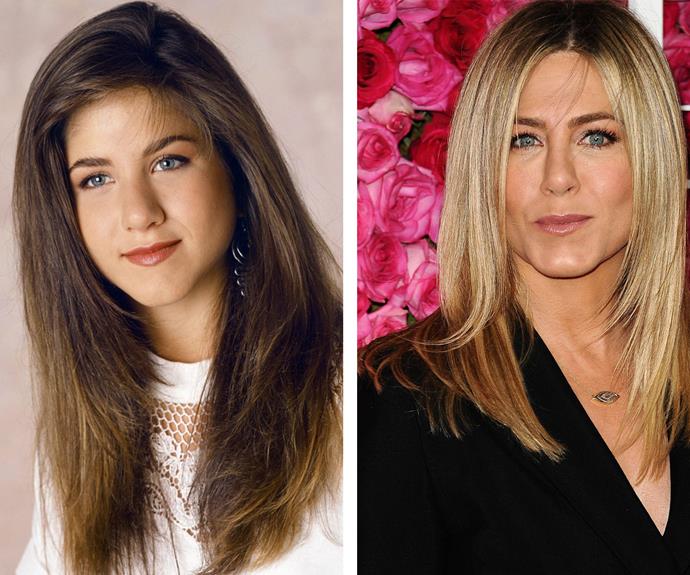 "Her youthful nose is too long and too wide for her face. Her adult nose is more refined yet far from perfect - there looks to be a gentle C-shaped deformity with a persistently wide mid-vault and a poorly defined tip," Dr James Southwell-Keely reveals of Jennifer Aniston's changing face.