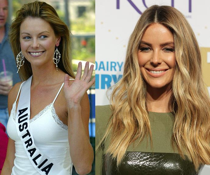 She rose to fame as the girl next door, who took out the Miss Universe competition in 2004 (L) but fast-forward to the present day and Jennifer Hawkins is "showing the hallmarks of too much filler," says Dr James Southwell-Keely.