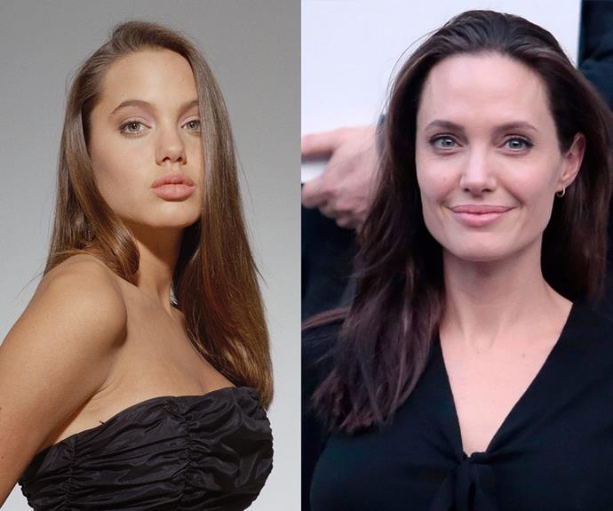 Angelina Jolie is often praised for keeping it real but our expert believes the mother-of-six has undergone a "nose job and subtle refinements."