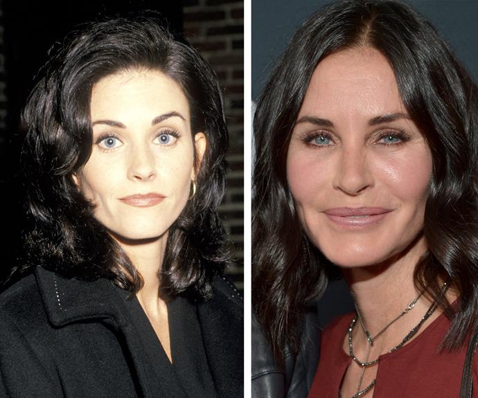 Then and now: A fresh-faced Courteney in 1995 on the left, and on the right the actress shows off a wrinkle-free forehead in 2015.