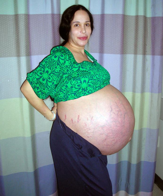 This was Natalie in 2009, just days before she welcomed her eight children.