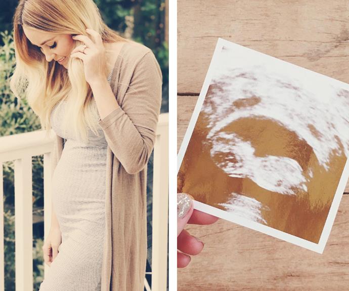 Lauren Conrad has debuted the "cutest baby bump ever" in a too-pretty-for-words snap on her [website](https://laurenconrad.com/|target="_blank"|rel=”nofollow”). "We can't wait to meet your little bundle, Lauren!," shared the former reality star's team. The blonde beauty announced that she and hubby William Tell were expecting their first child on New Year's Day with a photo of their sonogram.